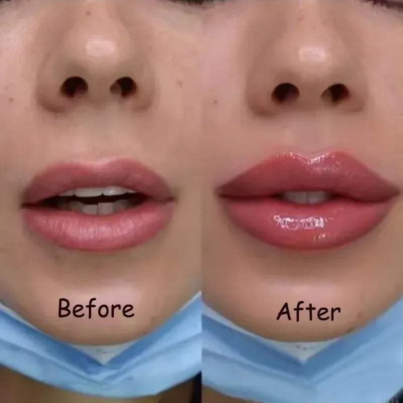 Instant Lip Plumper Oil – Hydrating Volumizing Gloss Serum 💋